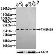 TMEM68 Polyclonal Antibody